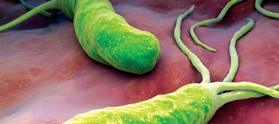 helicobacter pylori gaita testi labistanbul