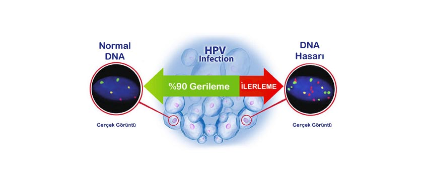 Papillomavírus hpv vírus HPV fertőzés
