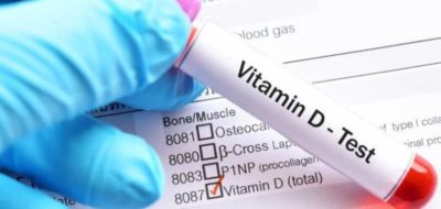 D Vitamini Testi